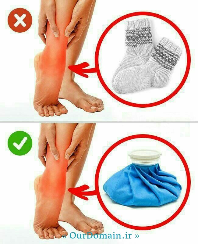 گرم کردن پای پیچ خورده اشتباه است