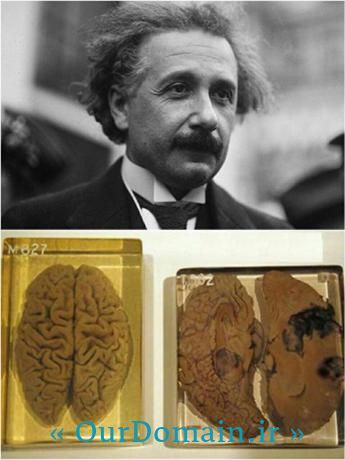 مغز آلبرت انیشتین ۱۲۳۰ گرم بوده است