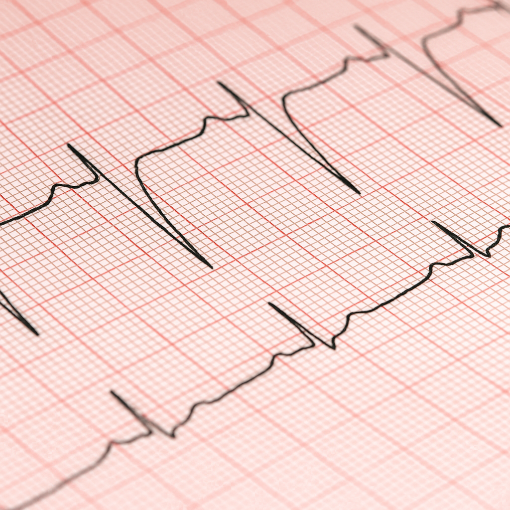جزوه نوار قلب (EKG) در ۳۰ ثانیه آموزش سریع، امتحانی و بالینی تفسیر ECG